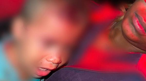 COITÉ - Após atingir mãe e bebê de 1 ano, motorista foge sem prestar socorro às vítimas 